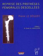 Couverture du livre « Reprises des protheses femorales descellees » de Le Beguec Pierre aux éditions Sauramps Medical