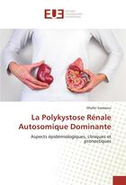 Couverture du livre « La polykystose rénale autosomique dominante ; aspects épidémiologiques, cliniques et pronostiques » de Dhafer Saadaoui aux éditions Editions Universitaires Europeennes