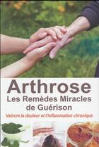 Couverture du livre « Arthrose ; les remèdes miracles de guérison » de Isabelle Estournel aux éditions Exclusif