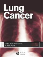 Couverture du livre « Lung Cancer » de Jack A. Roth et James D. Cox et Waun Ki Hong aux éditions Wiley-blackwell