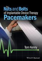 Couverture du livre « The Nuts and Bolts of Implantable Device Therapy » de Tom Kenny aux éditions Wiley-blackwell