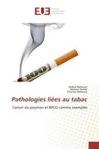 Couverture du livre « Pathologies liees au tabac - cancer du poumon et bpco comme exemples » de Belloumi/Hamdi aux éditions Editions Universitaires Europeennes