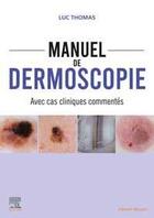 Couverture du livre « Manuel de dermoscopie : avec cas cliniques commentés » de Luc Thomas aux éditions Elsevier-masson