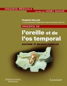 Couverture du livre « Imagerie de l'oreille et de l'os temporal Tome 1 ; anatomie et imagerie normales » de Francis Veillon aux éditions Medecine Sciences Publications