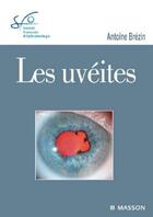 Couverture du livre « Décollement de la rétine ; rapport SFO 2011 » de Georges Caputo aux éditions Elsevier-masson