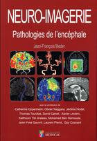 Couverture du livre « Neuro-imagerie ; pathologies de l'encéphale » de Jean-Francois Meder aux éditions Sauramps Medical
