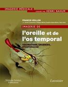 Couverture du livre « Imagerie de l'oreille et de l'os temporal Tome 3 ; traumatisme, urgences, otospongiose » de Francis Veillon aux éditions Medecine Sciences Publications