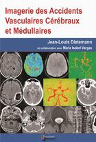 Couverture du livre « Imagerie des accidents vasculaires cérébraux et médullaires » de Jean-Louis Dieteman aux éditions Sauramps Medical