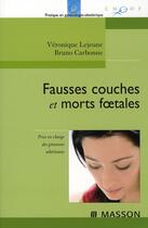 Couverture du livre « Fausses couches et morts foetales ; prise en charge des grossesses ultrieures » de Lejeune-V+Carbonne-B aux éditions Elsevier-masson