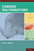 Couverture du livre « Common Malformations » de Holmes Lewis B aux éditions Oxford University Press Usa