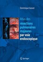 Couverture du livre « Atlas des résections pulmonaires majeures par voie endoscopique » de Dominique Gossot aux éditions Springer