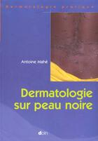 Couverture du livre « Dermatologie sur peau noire » de Mahe Antoine aux éditions Doin