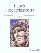 Couverture du livre « Plaies et cicatrisations » de Sylvie Meaume et Olivier Dereure aux éditions Elsevier-masson