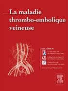 Couverture du livre « La maladie thromboembolique veineuse » de Philippe Lacroix et . Collectif aux éditions Elsevier-masson