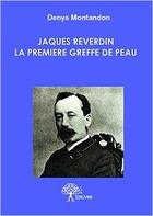 Couverture du livre « Jacques Reverdin ; la première greffe de peau » de Denys Montandon aux éditions Edilivre