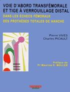 Couverture du livre « Voie transfemorale et tige a verrouillage distal dans les echecs femoraux des pt » de Picault/Vives aux éditions Sauramps Medical